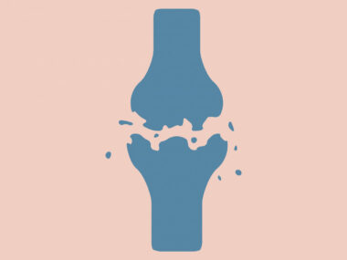 knee, hip surgery
