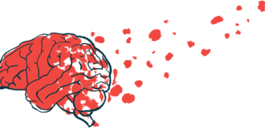 growth hormone treatment | Prader-Willi News | illustration of human brain