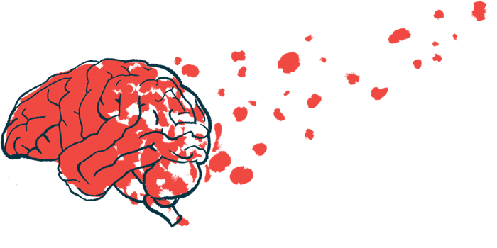 cerebellum | Prader-Willi News | illustration of human brain