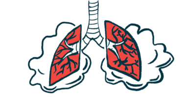 scoliosis surgery | Prader-Willi Syndrome News | illustration of lungs