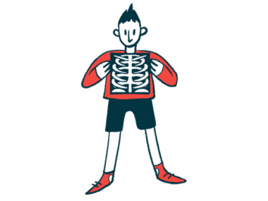 A person holds up an X-ray in this illustration.