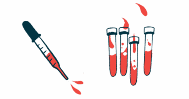 A squirting dropper is pictured alongside four vials, each half-filled with a fluid.