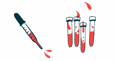 A squirting dropper is pictured alongside four vials, each half-filled with a fluid.