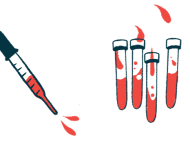 A squirting dropper is pictured alongside four vials, each half-filled with a fluid.