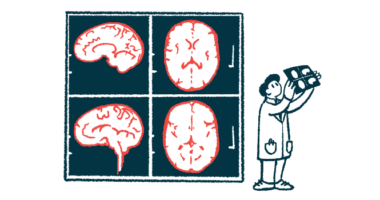 An illustration of a doctor looking at images of the brain.