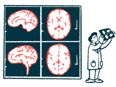 An illustration of a doctor looking at images of the brain.