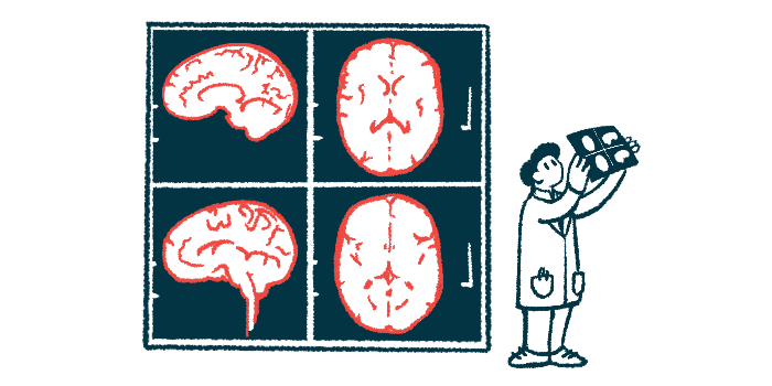 An illustration of a doctor looking at images of the brain.