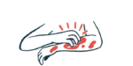 A person's hand is shown scratching the other arm, which is covered in red blotches.