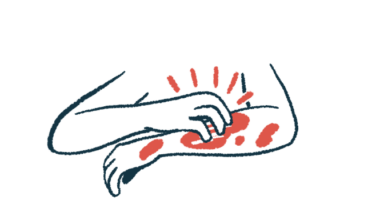 A person's hand is shown scratching the other arm, which is covered in red blotches.