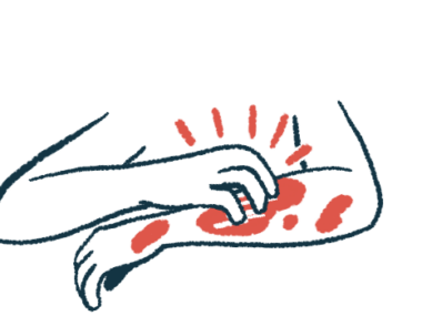 A person's hand is shown scratching the other arm, which is covered in red blotches.